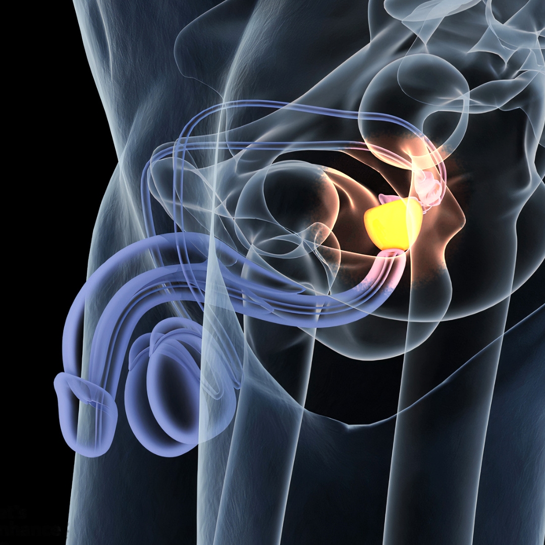 hiperplacia prostatica